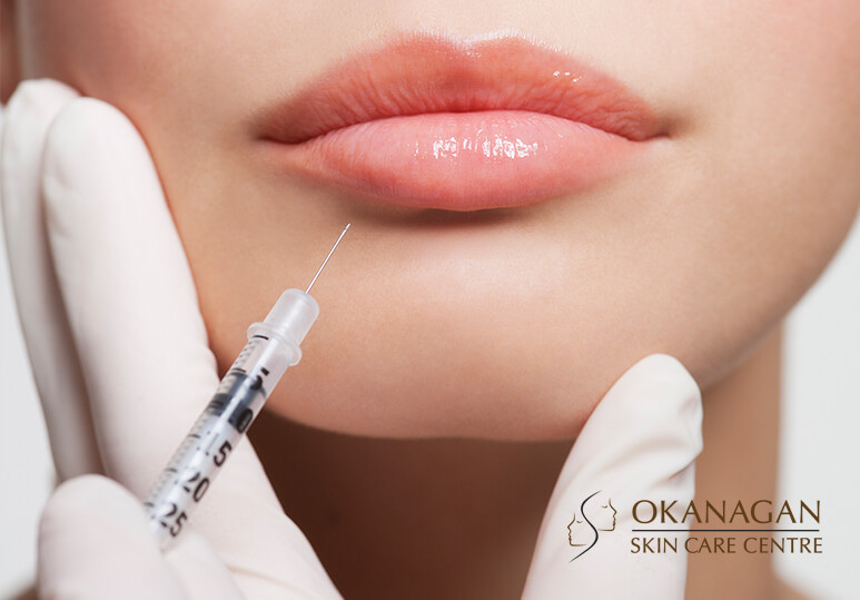 Okanagan Skin Care - blog - Botox